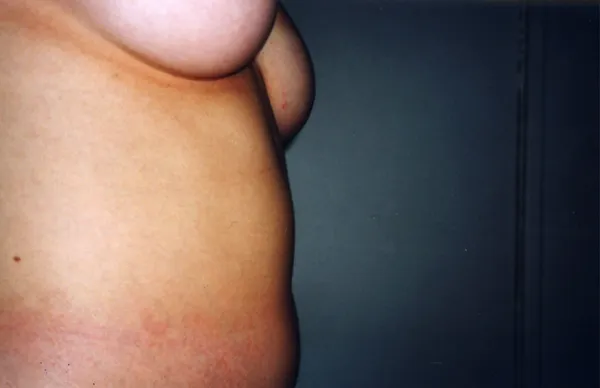 Autodispersée — photographie 36