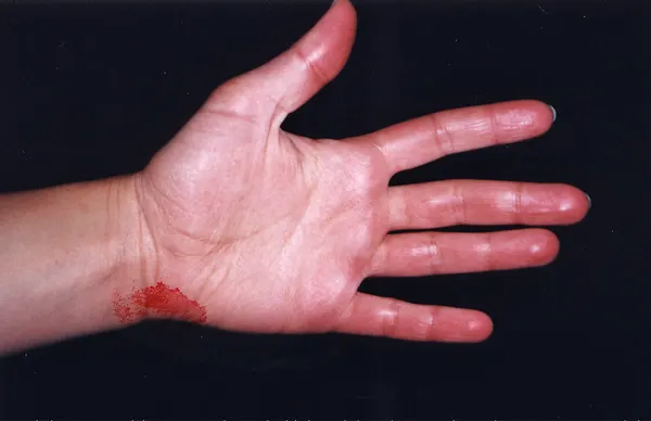 Autodispersée — photographie 80