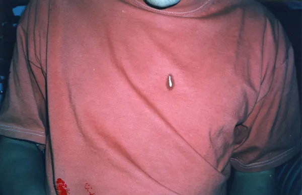 Autodispersée — photographie 76
